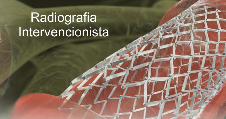 ServiÃ§o de hemodinÃ¢mica e radiologia vascular em Curitiba